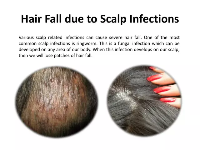 The Connection Between Ringworm and Hair Loss: What You Should Know