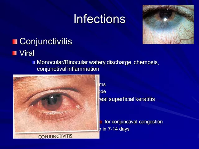 Understanding Bacterial Eye Infections: Causes, Symptoms, and Treatments